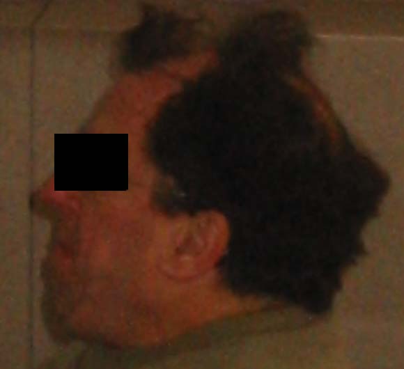 Baby Huey Tuft with Comb Over